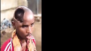 Somali Man Somehow Functions With Half His Brain Missing