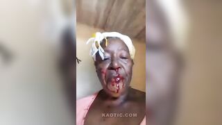 Bleeding Woman Attacked By Own Daughter While Making A Video