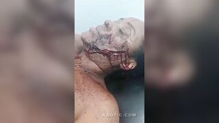 Woman Attacked With Machete