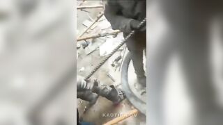 BrazilianWorker Impaled By Rebar