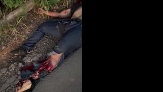 Gruesome Aftermath On Brazilian Road