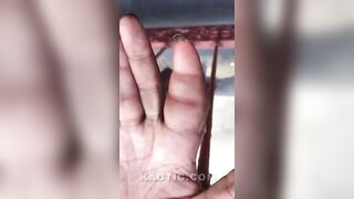 Finger stuck with engagement ring