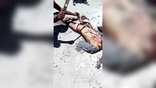 This Is How Castration Looks Like  In Haiti