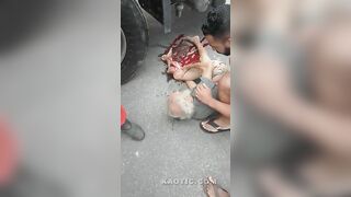 Old Man Badly Injured In A Traffic Accident