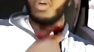 Battle Scars? Dude Goes Live After Being Shot in the Neck