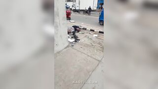 Man Lost Leg In Accident In Peru