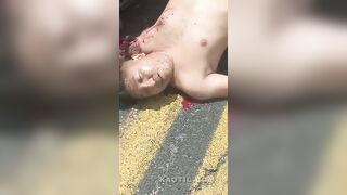 Poor Guy Dismembered By Hit & Run Driver