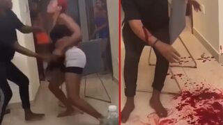 Lady sustains deep cut from a fight with a friend, dies avoidable death from blood loss - Port Harcourt, Nigeria