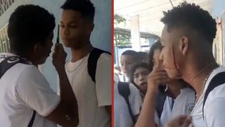 Victim of bullying has enough and slices his bully across the cheek in Colombia