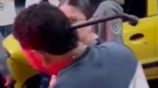 Man got the back of his head penetrated with a tire iron during a street fight in Colombia
