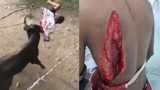 Mans back was torn open by a Bull