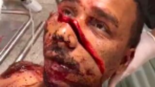 Man still alive but with his face split in half after getting attacked with a sharp machete in Brazil