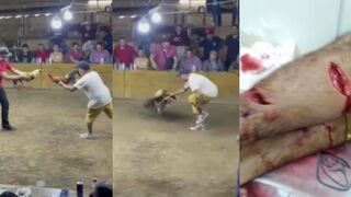 Fighting Hen turns agains't his owner and leaves him with open leg wounds