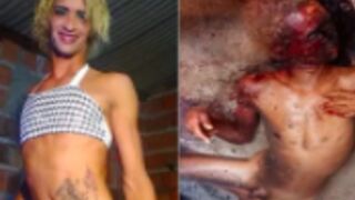 Transgender was tortured before being burned alive in Brazil