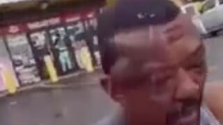 Guy records his victims face after beating him up to show off his injuries