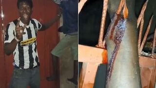 Thief gets his hand impaled on a metal spike fence for two hours