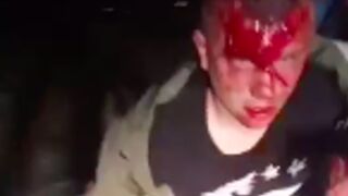 Russian pedo left with a bloody face after he was caught dating a 14 year old