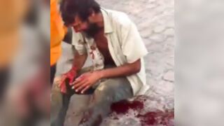 Homeless man gets attacked with a machete in Brazil