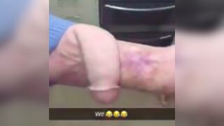No Homo: This man has got a penis growing off his arm! ????