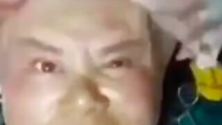 WOW: Woman gets her face swapped whilst awake!