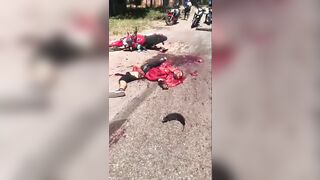 video of accident consequences- An unlucky day for a motorbike rider