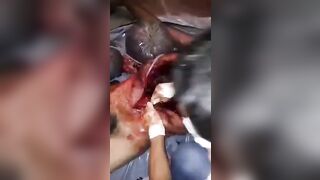 Autopsy video of an elderly man