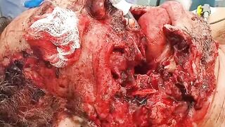 Gore video- The man had an accident that left his face badly damaged
