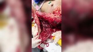 Gore video - The skin on her hand was peeled off by the motorcycle accident