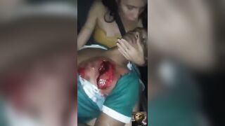 Gore video- They were taking a man who had been slashed in the lung to the hospital