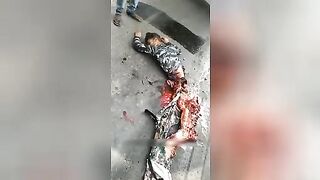 Accident Video - The guy is still alive even though his lower half is completely crushed