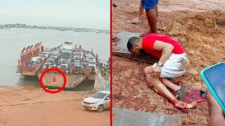 Young man's leg is crushed after jumping from a moving ferry - Itaituba, Brazil