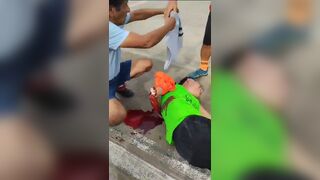 Amateur Soccer Player Suffers Terrible Injury