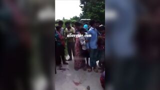 Woman's head popped away from her skin layer in an incident india.