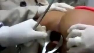 Butt Sex Sends Poor Girl to the ER