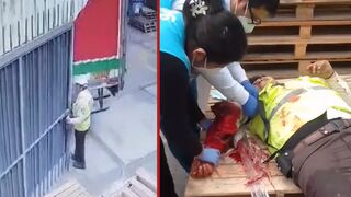 Security agent loses his arm during freak accident at work - Peru