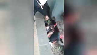 A teenager was hit by a train and lost his leg. Video