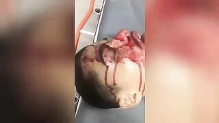 Corpse with a gunshot wound to the head.Video.