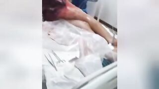 Terrible hip injury. Explosive fart. Video.