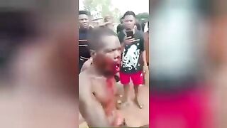 Someone gave the nigga a second mouth. Trauma. Video