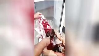 Migrants scalped a young guy. Video. Elektrostal.