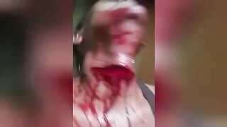 Man cuts his throat. India. Video.