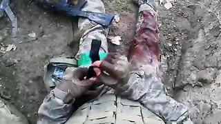 Wounded Ukrainian soldier, Video. Ukraine.