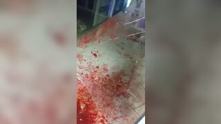 Man Cut By Glass