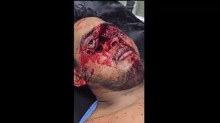 Biker Suffers Terrible Face Injury