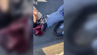 Dominican Biker Suffers Terrible Injury Fully Awake